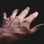 vein detector price in pakistan – Detailed image of a human hand showing prominent veins against a dark background.