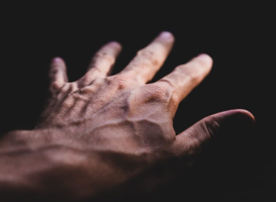 vein detector price in pakistan – Detailed image of a human hand showing prominent veins against a dark background.