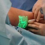 vein detector price in pakistan – A doctor performs a medical procedure using advanced vein visualization technology.